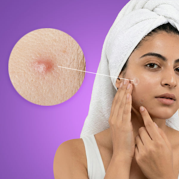 Pimple Patches – Unisex Transparent Acne Care (36 Patches)